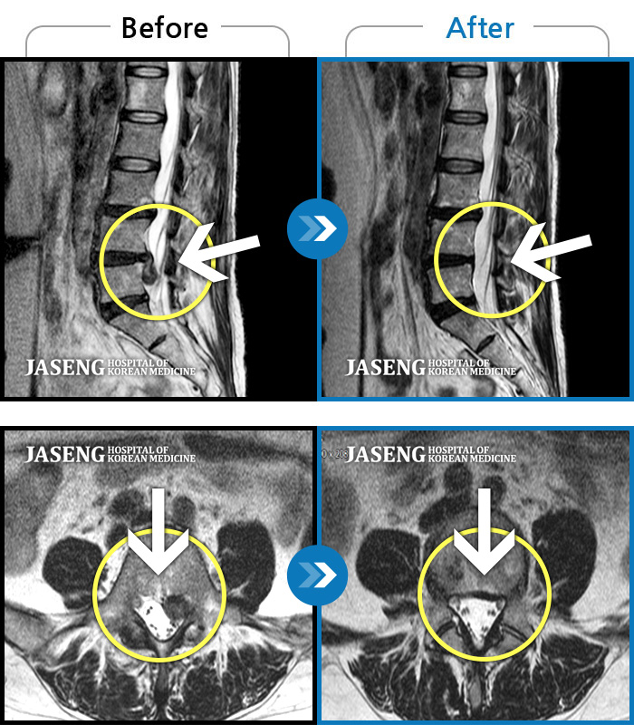 λڻѹ溴 ġ MRI  ġ-ä ϰ  ٸ  ȵ.