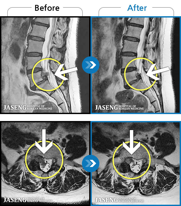 ڻѹ溴 ġ MRI  ġ- ġ ƻ    ȵ.