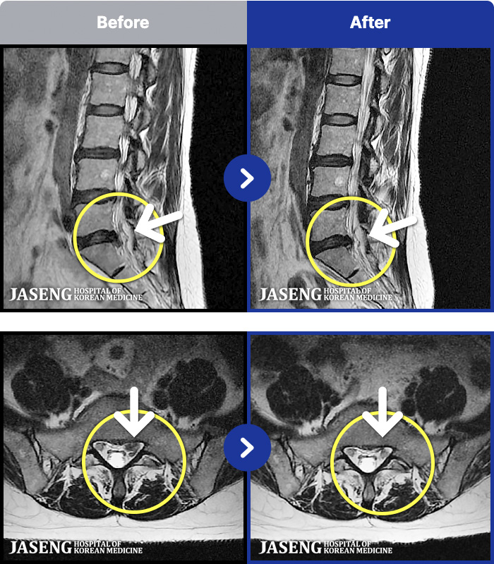 �����ڻ��ѹ溴�� ġ���� MRI�� ���� ġ����-���� �кο� �ٸ��� ������ �ٸ� �ٷ����Ϸ� ����Ÿ�.