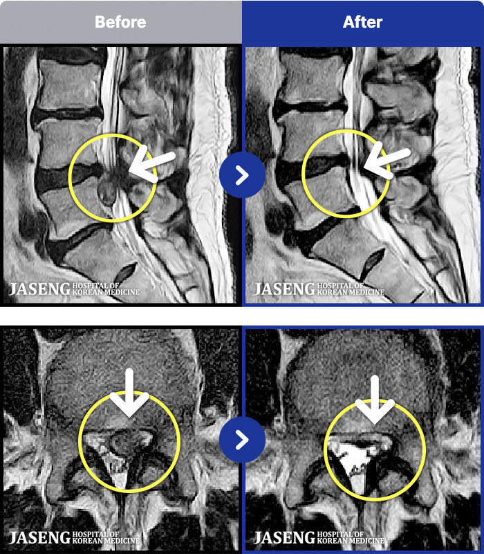 õ���ڻ��ѹ溴�� ġ���� MRI�� ���� ġ����-�����㸮 ��� ������ �ؽ��ϰ� ���� �ٸ��� ������ ���ؼ� �߹ٴڱ��� ����