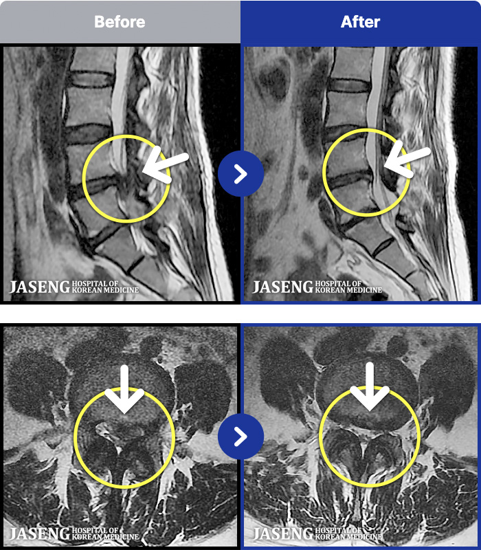 ڻѹ溴 ġ MRI ġ-㸮, ݺ ٸ ӵǰ, ٸ , Ͽ,