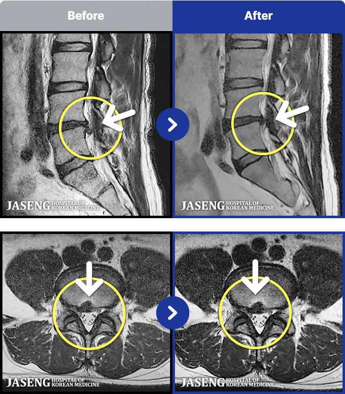 ڻѹ溴 ġ MRI ġ- ϰ ӵǸ ٷ