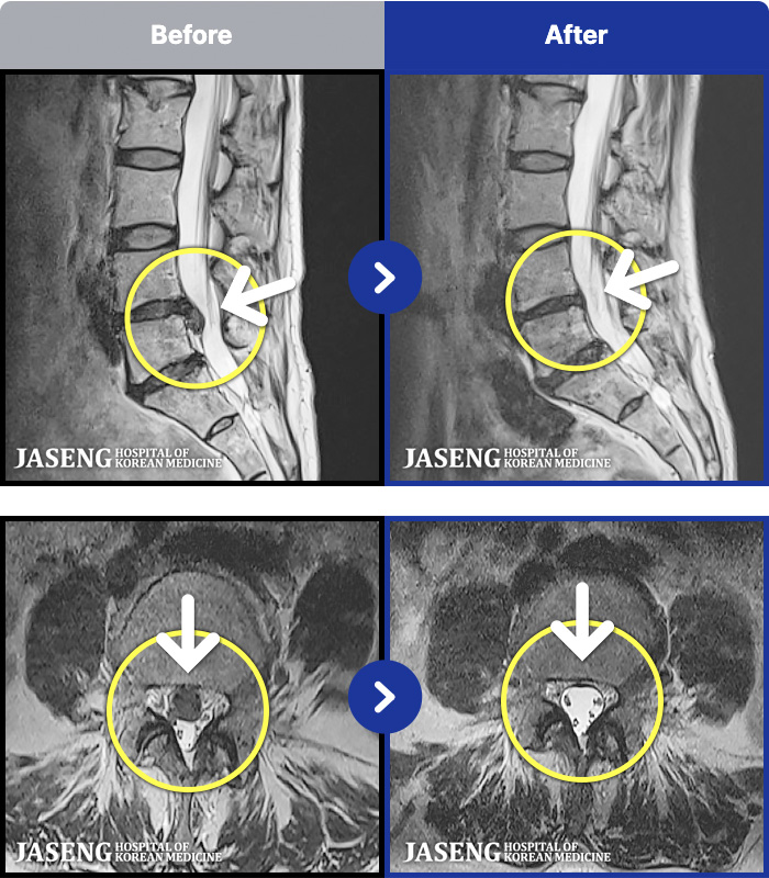 ڻѹ溴 ġ MRI ġ-㸮 ٸ