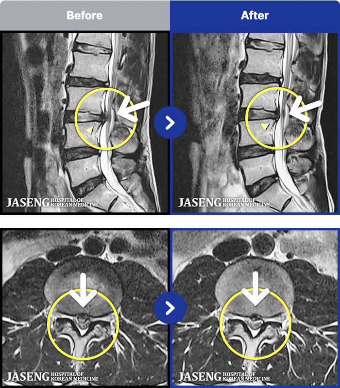 ڻѹ溴 ġ MRI ġ-㸮 , ٸ ȭǾ ϼ̽ϴ.