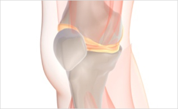 울산자생한방병원 무릎질환 무릎점액낭염-무릎점액낭염 관련 사진 입니다.