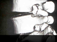 울산자생한방병원 허리질환 퇴행성디스크-정상척추에 관련된 이미지 입니다.