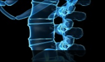 울산자생한방병원 허리질환 척추전방전위증-정상적인 사람의 척추뼈 모습입니다.