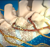 울산자생한방병원 허리치료법 신경근회복술-신경근회복술의 특징 네번째 관련 사진 입니다.
